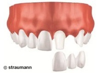 Bild 2 Image