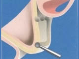 Bild 8c Image